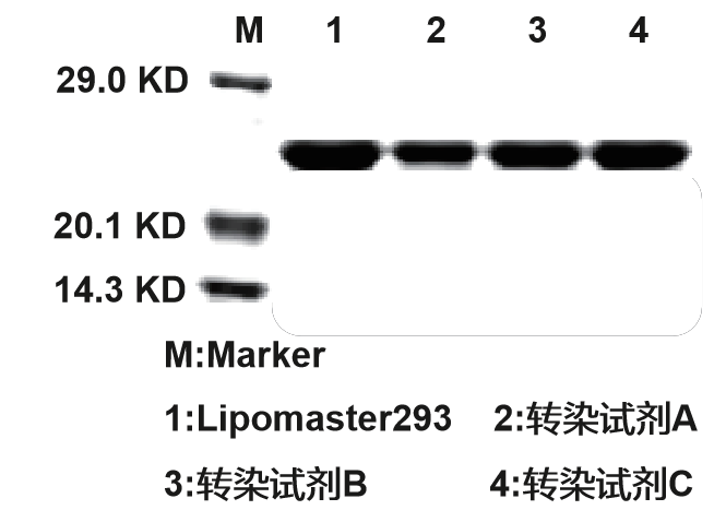 Lipomaster 293 Transfection Reagent HEK293细胞表达平台 产品中心 南京诺唯赞生物科技股份有限公司