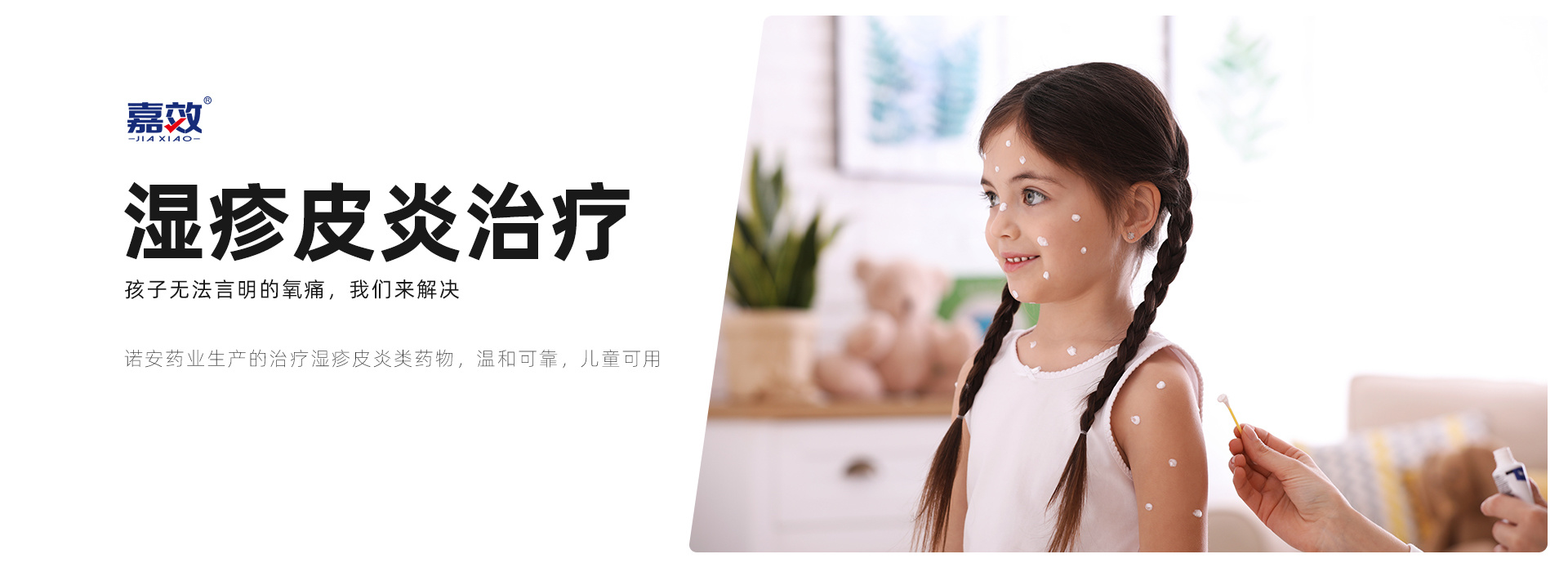 濕疹皮炎治療 濕疹皮炎治療