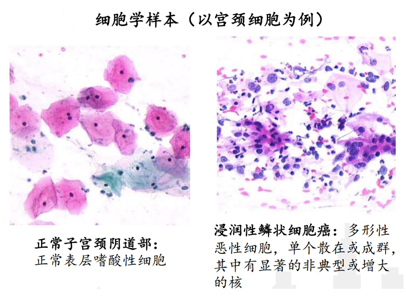 如何读懂病理诊断报告_武汉弘康医学检验实验室股份有限公司| 国家生物