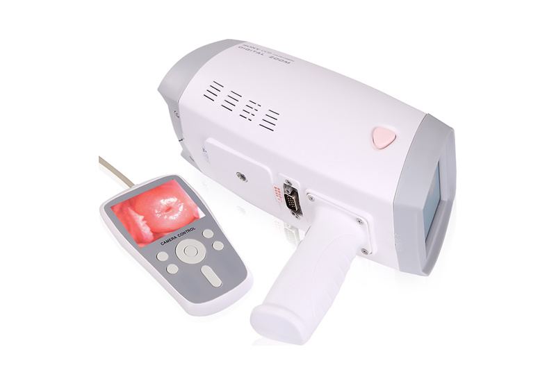 Handheld Video Colposcope