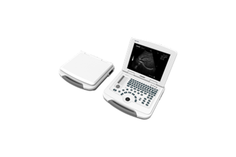 Portable Color Doppler Ultrasound Scanner