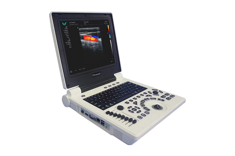 Laptop Color Doppler Ultrasonic Diagnostic System Portable Ultrasound Scanner