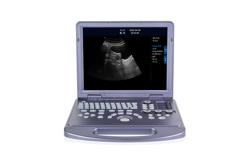 Portable Color Doppler Ultrasound Scanner