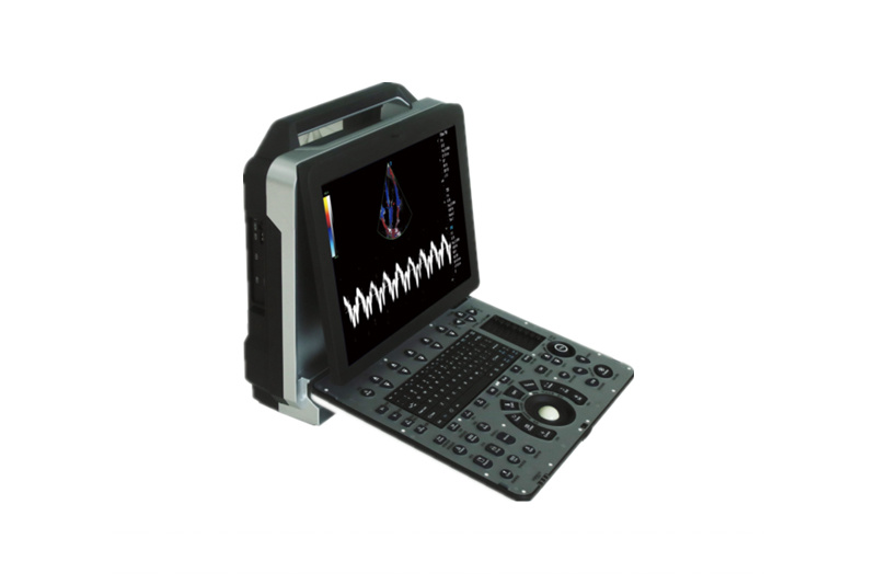 Color Doppler Ultrasonic Diagnostic System Portable Ultrasound Scanner