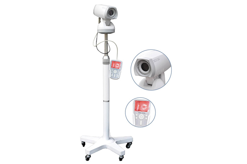 Video Colposcope with Tripod