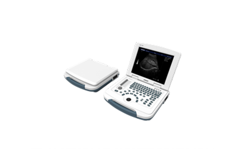 Portable Color Doppler Ultrasound Scanner
