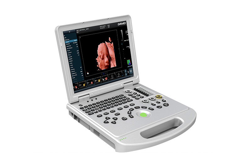 Portable Color Doppler Ultrasound Ultrasound Scanner