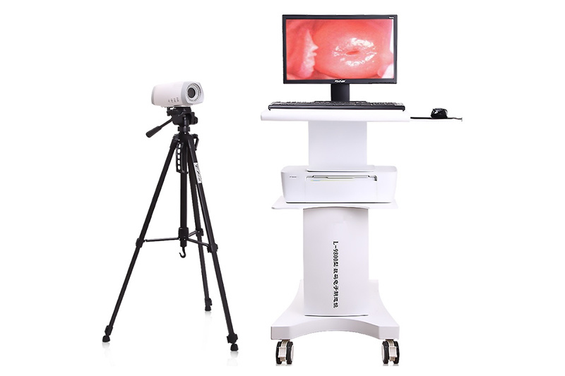 Trolley Digital Colposcope
