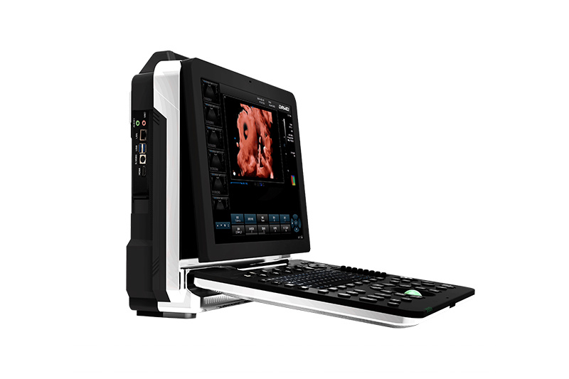 Portable Color Doppler Ultrasound Ultrasound Scanner