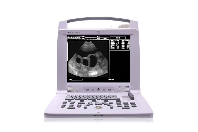 Veterinária portátil ultra-som Scanner