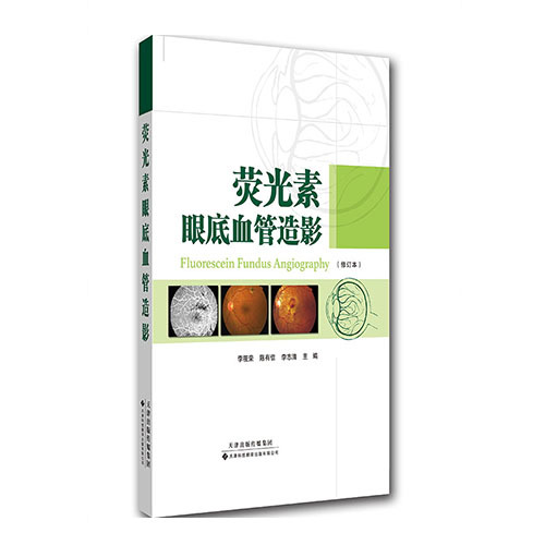 熒光素眼底血管造影