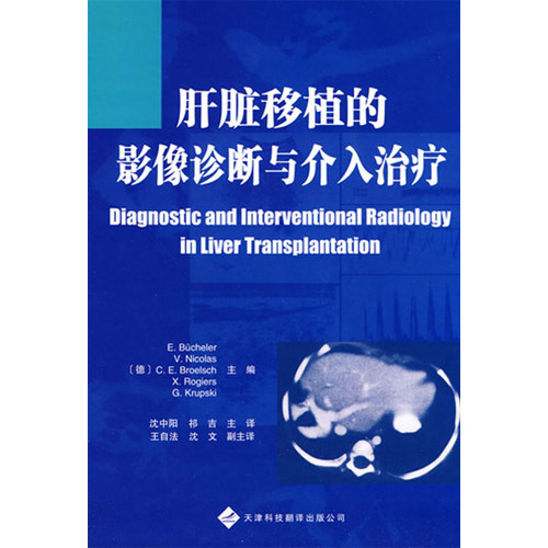 肝臟移植的影像診斷與介入治療