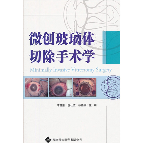 微創(chuàng)玻璃體切除手術(shù)學(xué)