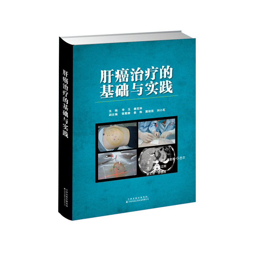 肝癌治療的基礎與實踐