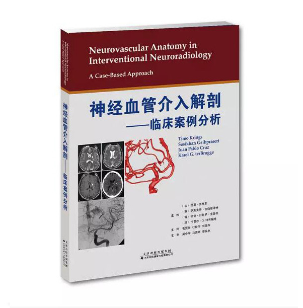 神經血管介入解剖—臨床案例分析