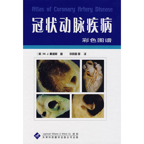 冠狀動脈疾病彩色圖譜
