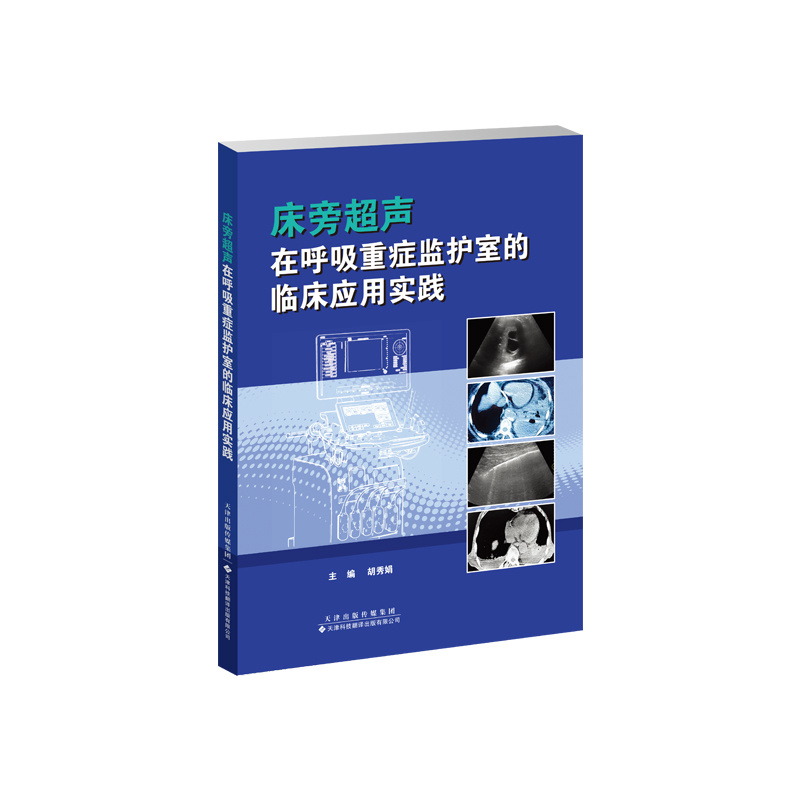 床旁超聲在呼吸重癥監(jiān)護室的臨床應用實踐