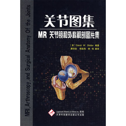 關(guān)節(jié)圖集MR關(guān)節(jié)鏡和外科解剖圖片集