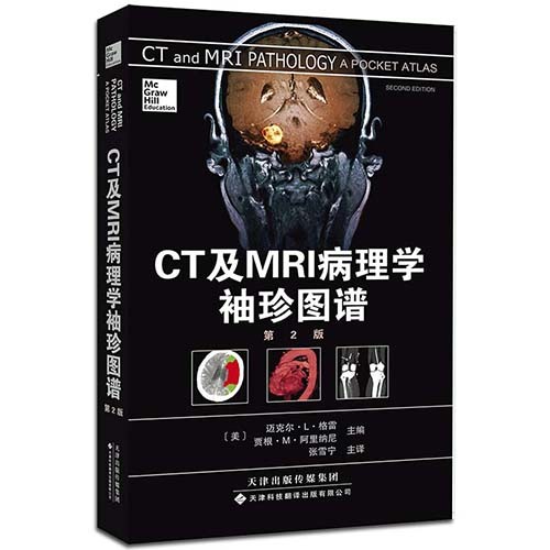 CT及MRI病理學袖珍圖譜 （國外引進）（中文翻譯）