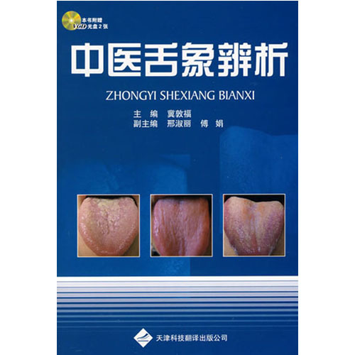 中醫(yī)舌象辨析（隨書附贈(zèng)2VCD）