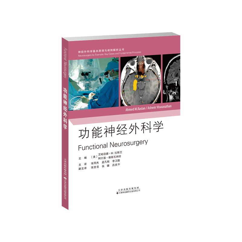 功能神經(jīng)外科學(xué)