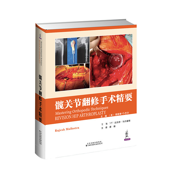 髖關節翻修手術精要