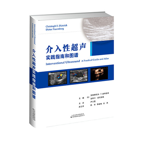 介入性超聲實踐指南和圖譜