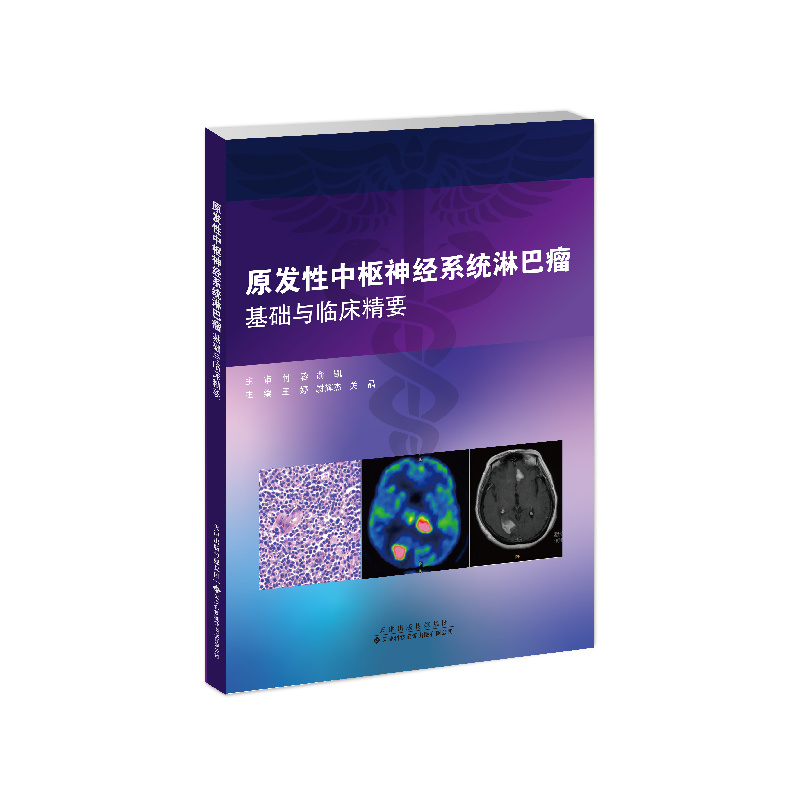 原發(fā)性中樞神經(jīng)系統淋巴瘤基礎與臨床精要