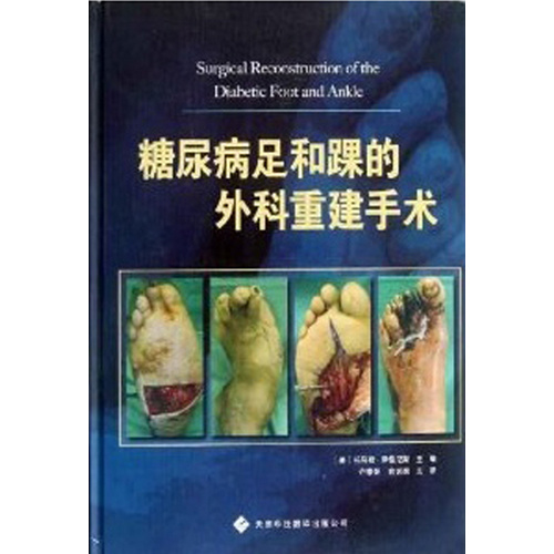 糖尿病足和踝的外科重建手術(shù)