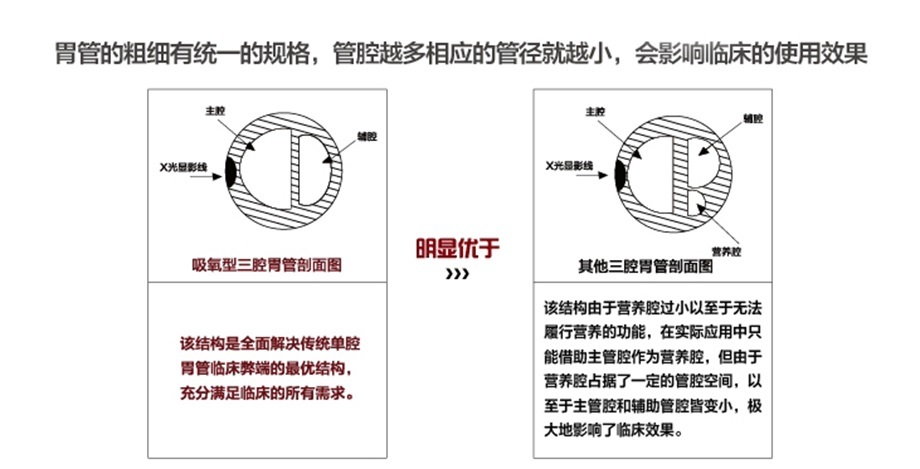 三腔胃管