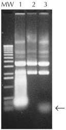 http://www.epibio.com/images/default-source/product-page-images/rnase_i_final.jpg?sfvrsn=0.7945674397749082