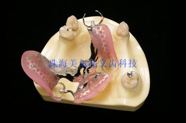 精密附件