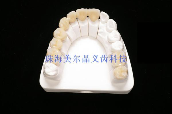 Ordinary porcelain