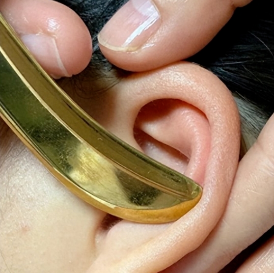 中医特色疗法｜耳鸣耳聋——耳部刮痧来帮你