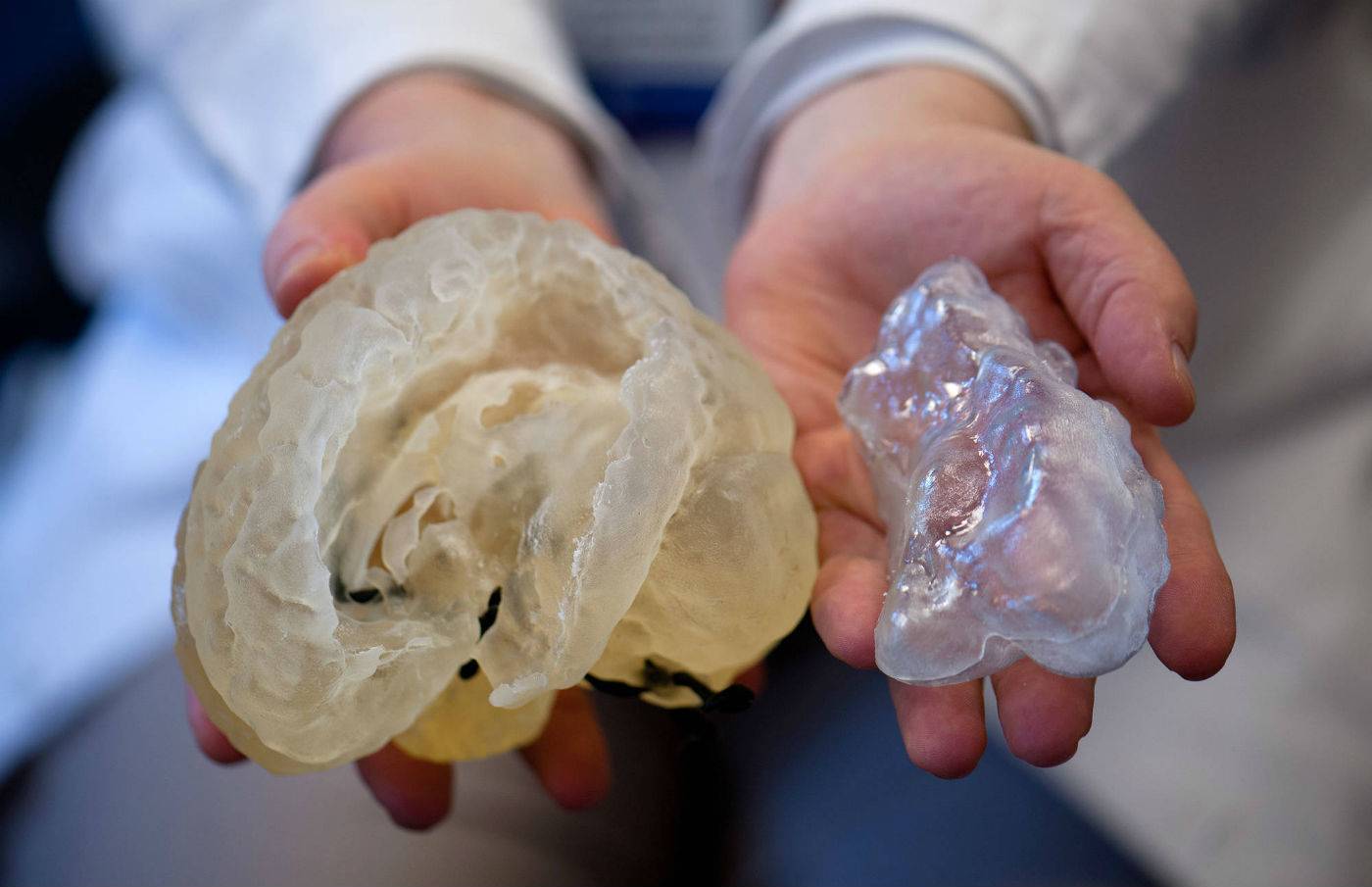 Successful 3D printing of human brain tissue enables normal growth and functional operation