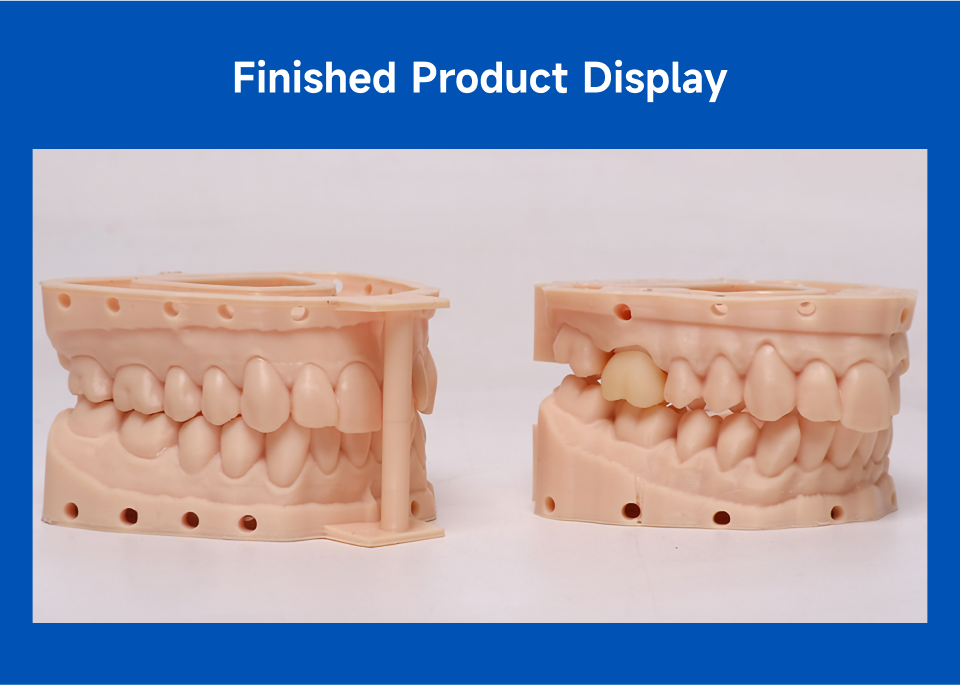 Goofoo DM100 UV LCD 3D Printer Dental Restoration Model Resin