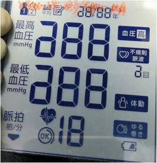 YDDC41573 TN