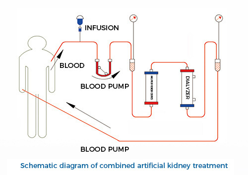 blood perfusion device