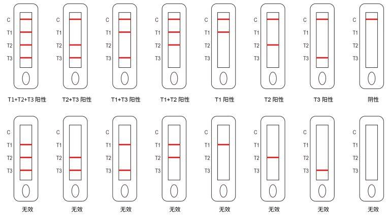 登革热IgG/IgM/NS1检测试剂盒(胶体金法)