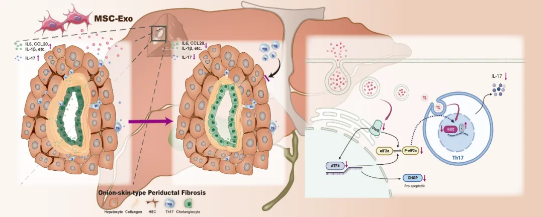 AJPS丨李兰娟院士/曹红翠教授团队：间充质干细胞来源外泌体可改善原发性硬化性胆管炎肝纤维化