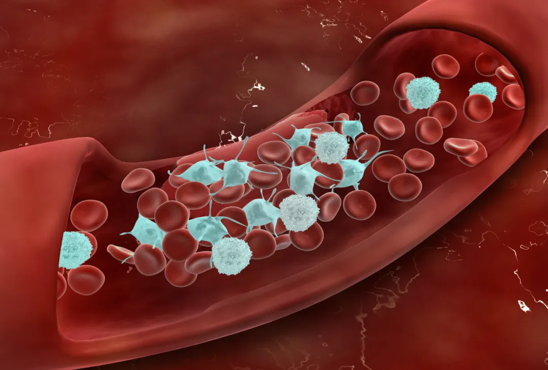 血栓人群的福音——干细胞可修复损伤血管！
