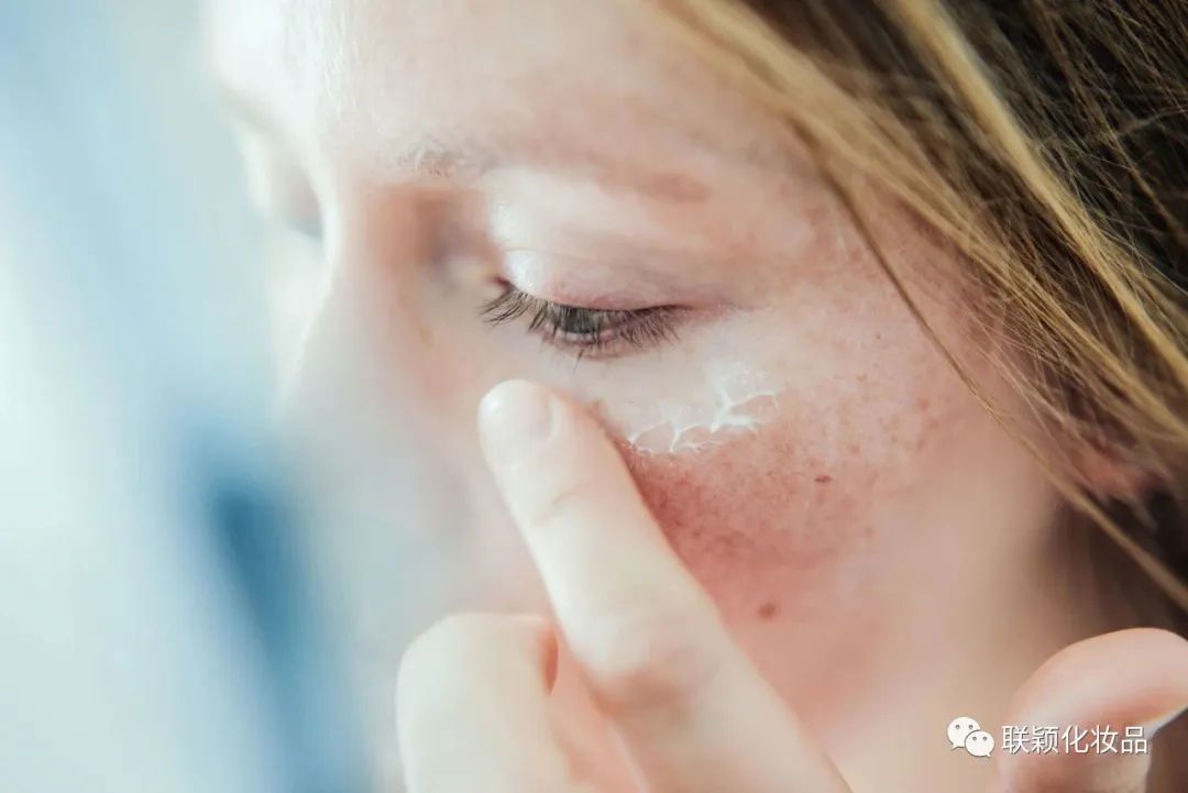 护肤探索 | 什么是皮肤炎症？如何有效抗炎？