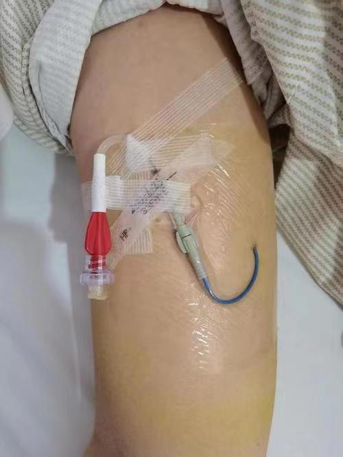 picc医疗设备的简单介绍 picc医疗装备
的简单

先容
（picc装置） 医疗设备