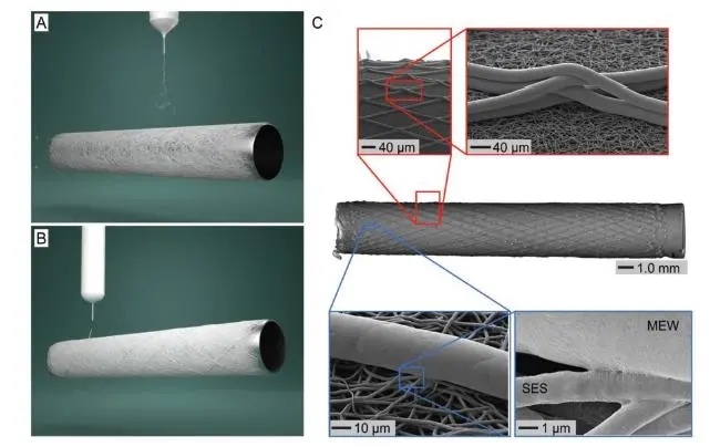 静电纺丝与熔融静电打印复合制造小直径人工血管支架