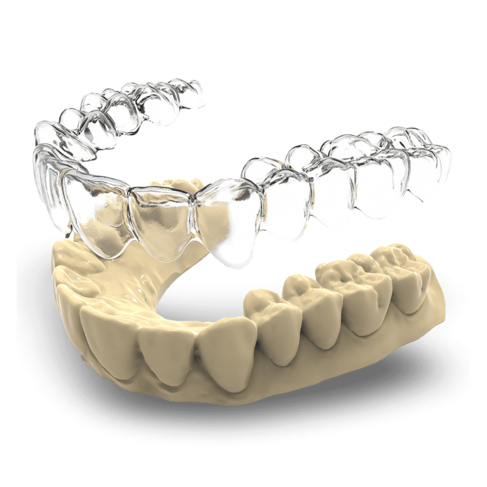 Glorysmile Orthodontic Braces Servicio de personalización privado, alineador invisible