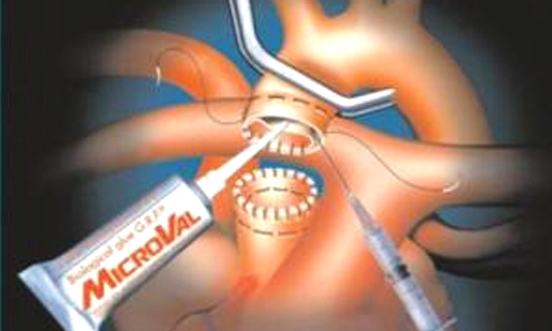 新技术：用“生物胶水”把细小血管粘接起来，避免缝合副作用！