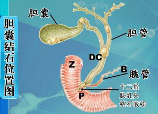 首先要從膽囊的解剖來說明這個問題,膽囊的神經由交感神經,副交感神經