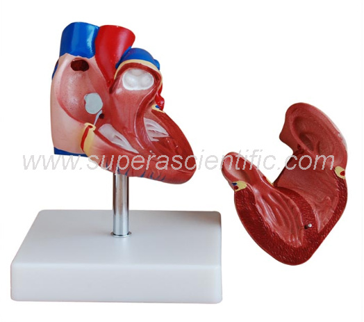 SA-307B New Style Life-Size Heart Model