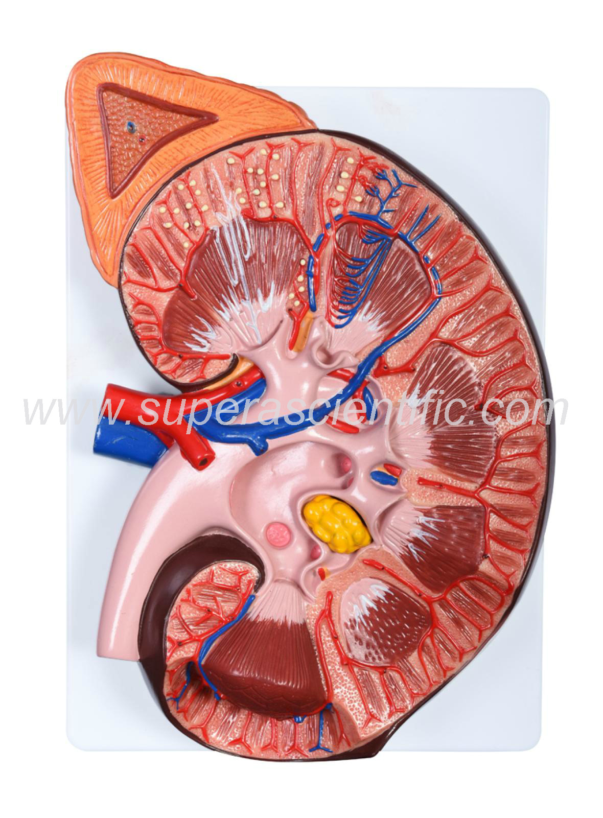 SA-310-4 Enlarged Kidney Model 1 Part