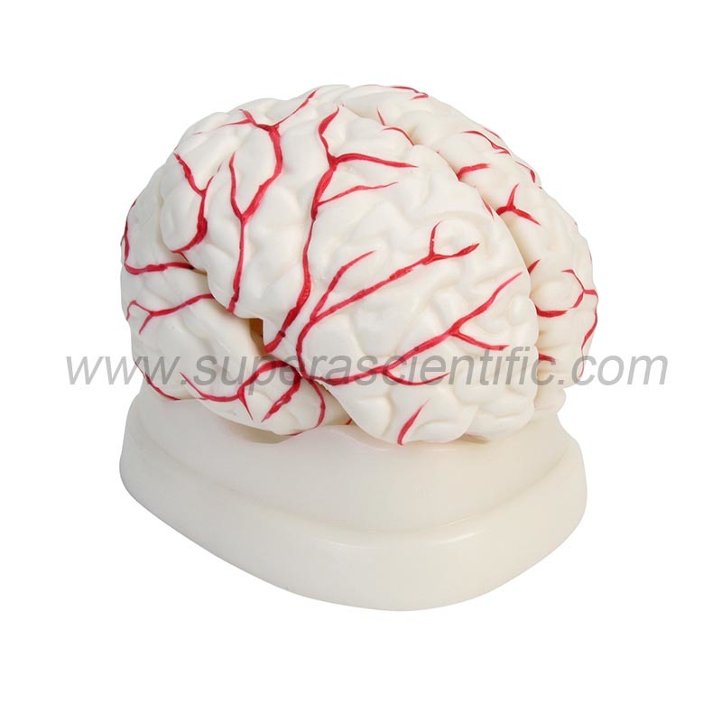 SA-308 Brain with Arteries